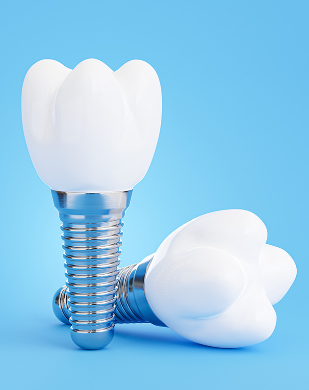 dental implants