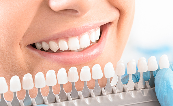 teeth whitening comparison chart