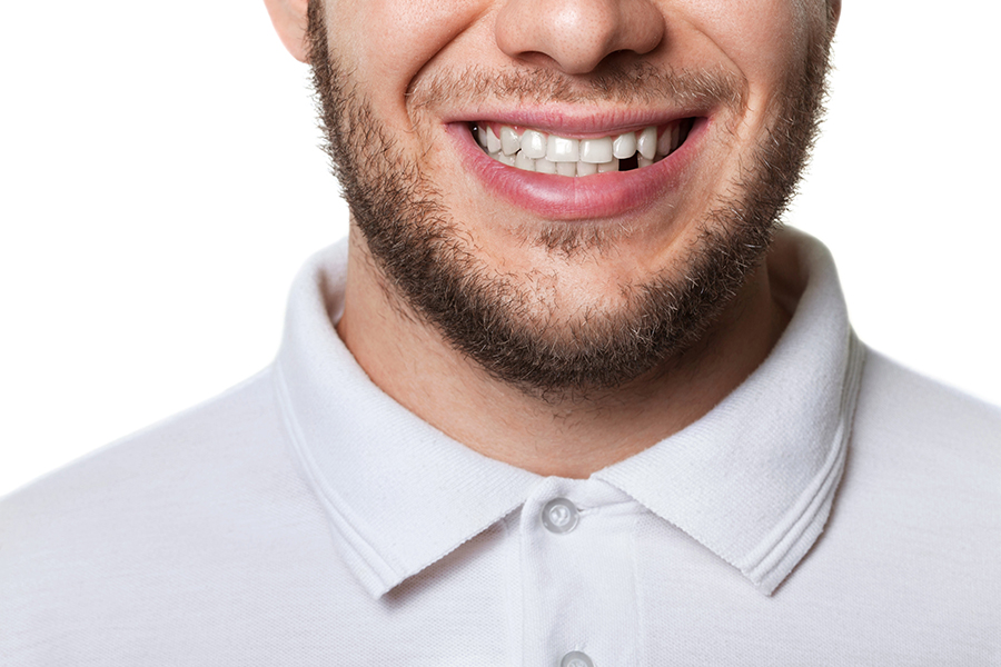 Missing tooth clause